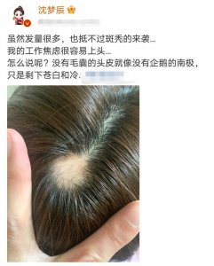 主持人沈梦辰遭遇斑秃,雍禾植发医生建议查明病因科学诊治